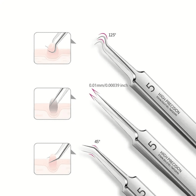 Professional Blackhead Tweezers - Designed for Smooth, Clear Skin (3pcs)