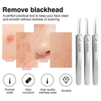 Professional Blackhead Tweezers - Designed for Smooth, Clear Skin (3pcs)